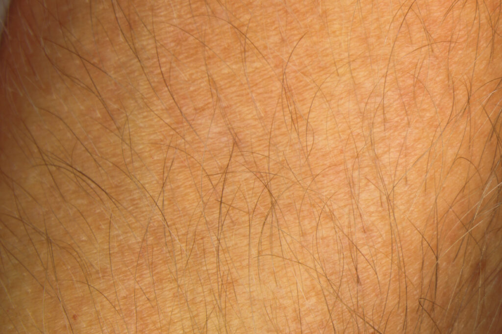 close up photo of human skin