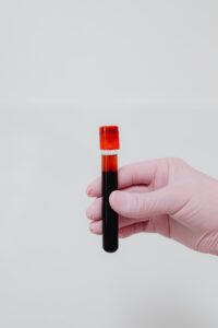 blood sample image